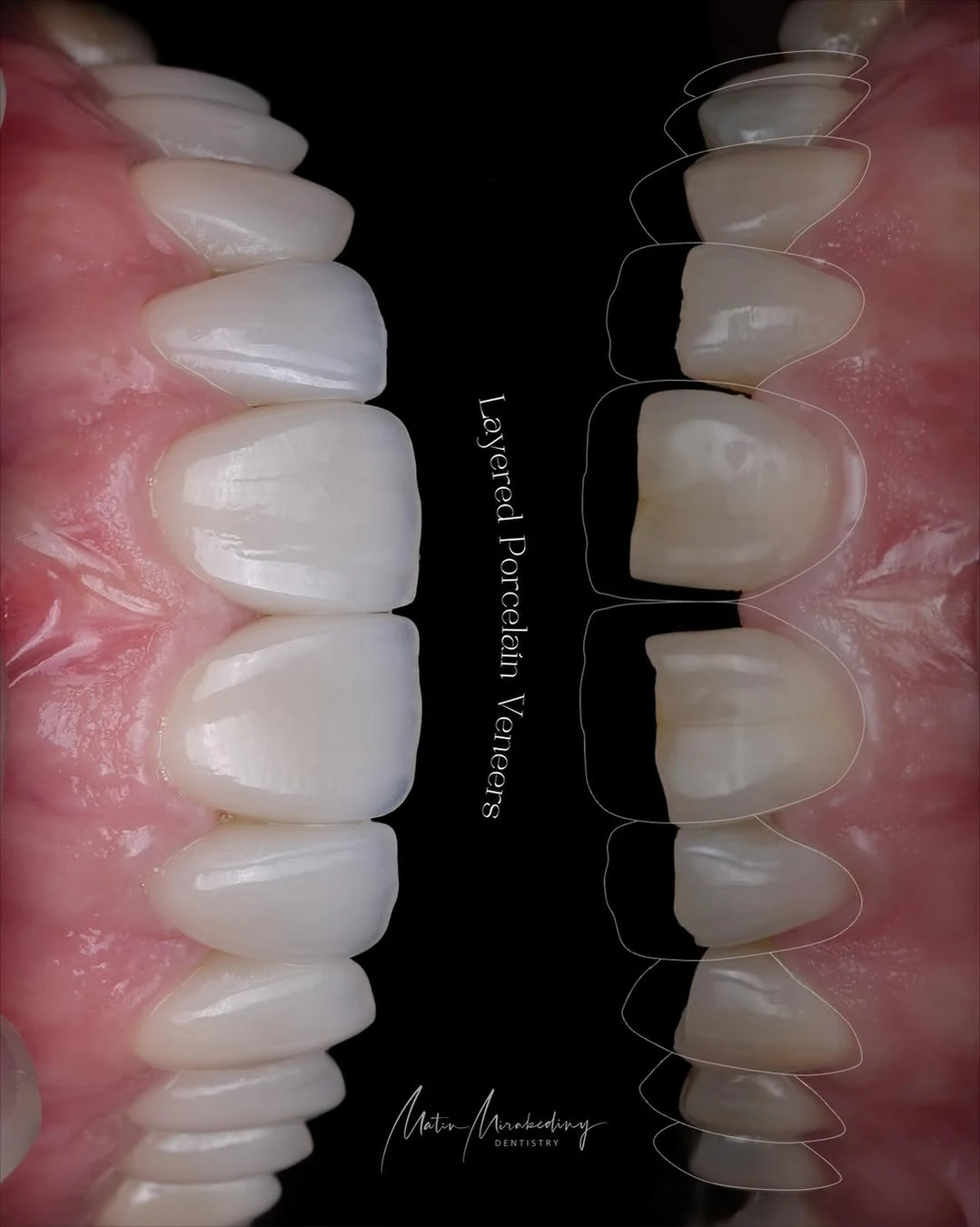 Facial balance case — slide 1