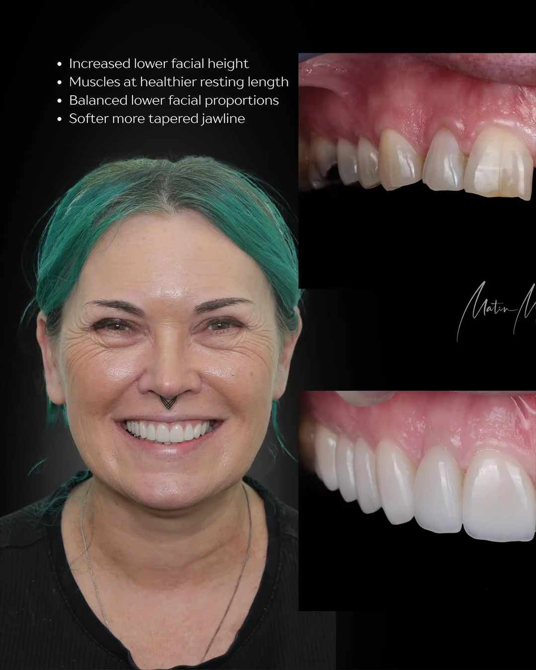 Facial balance case — slide 2