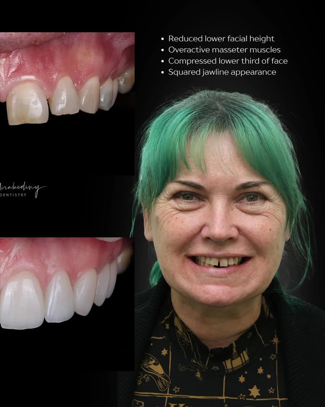 Facial balance case — slide 3