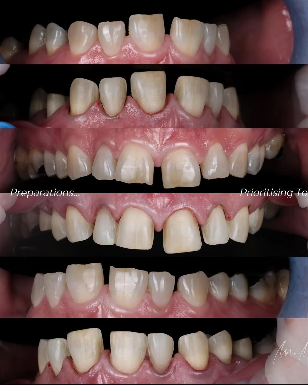 Facial balance case — slide 4