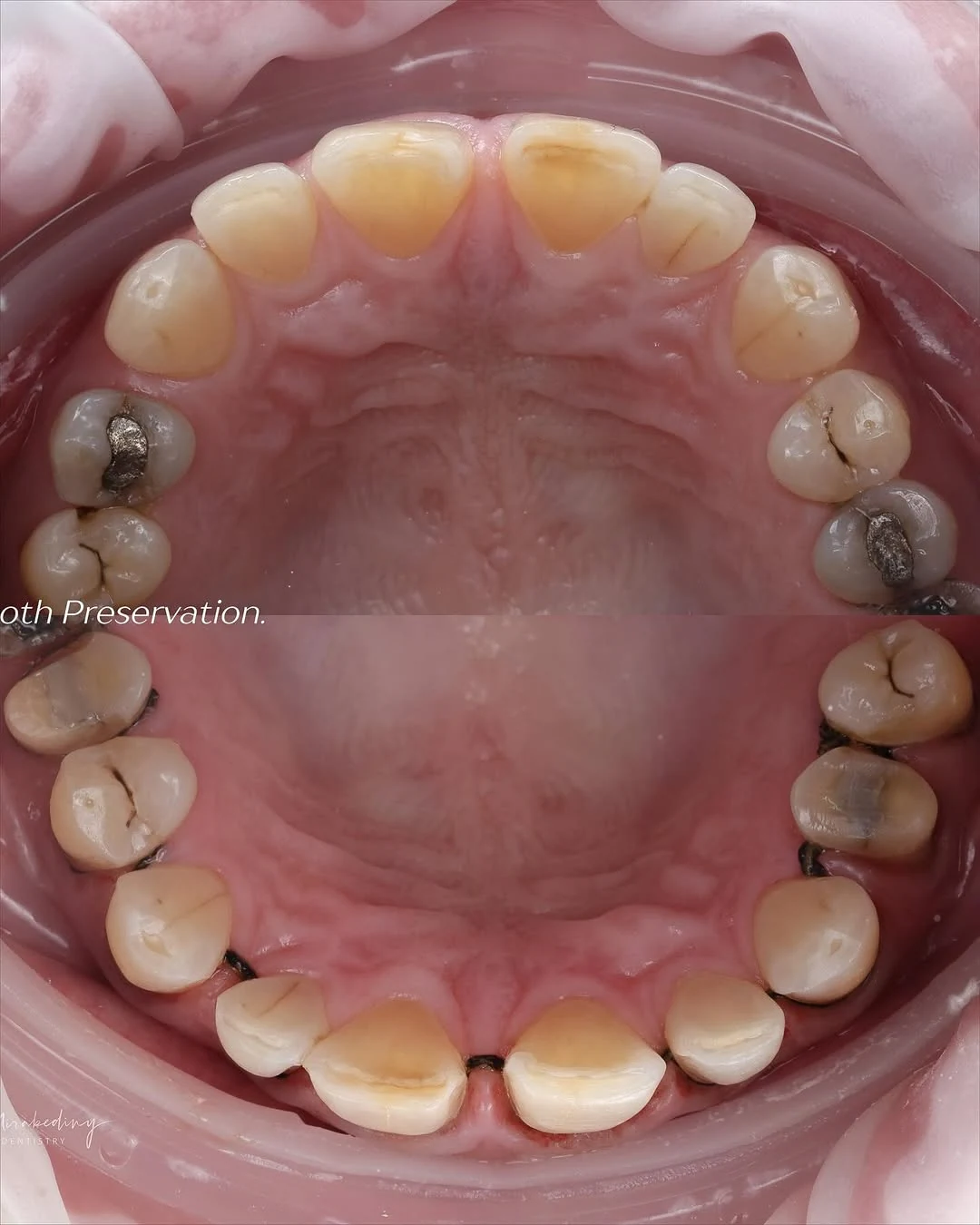 Facial balance case — slide 5
