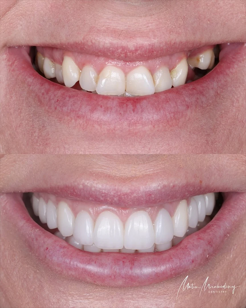 Pink and white case — before and after