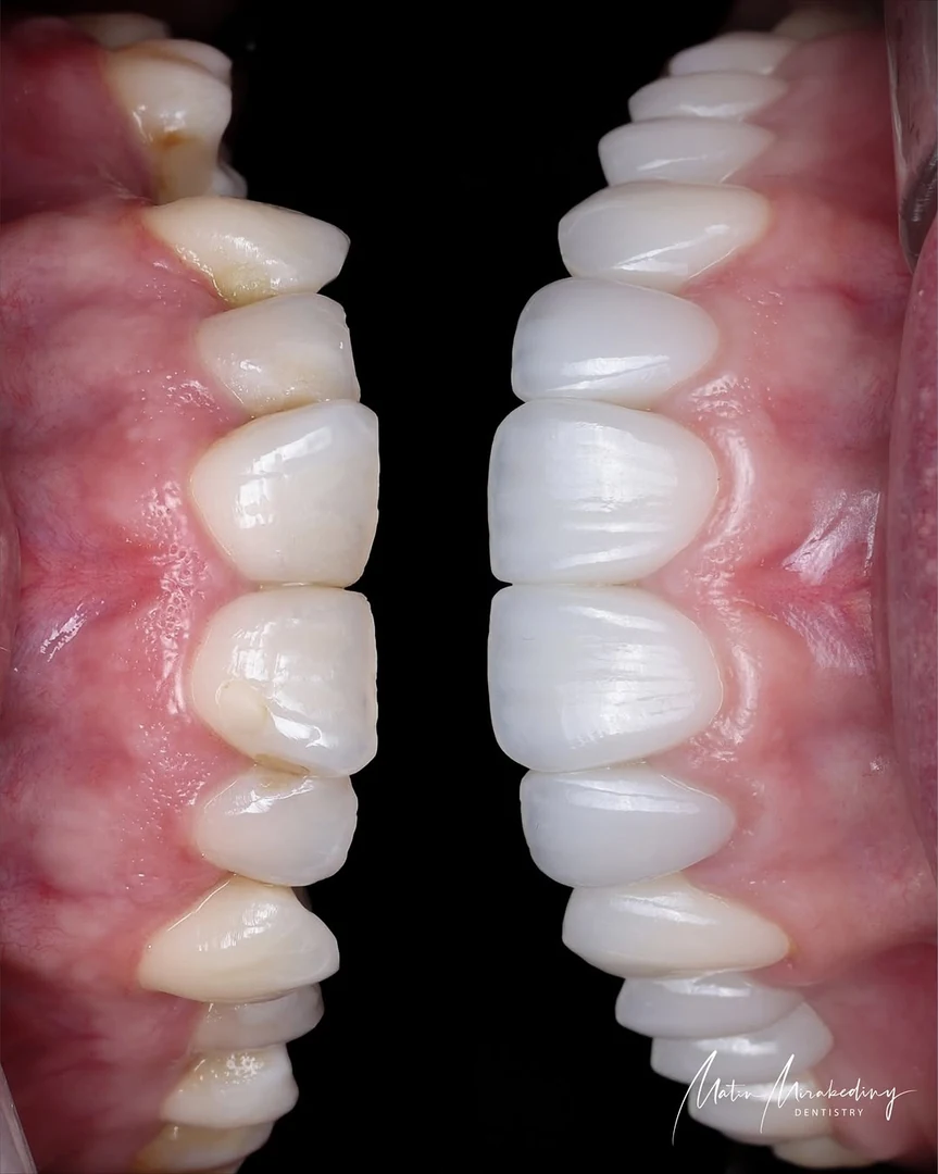 Pink and white case — final detail