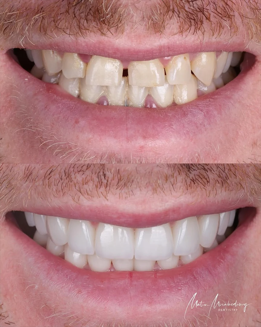 Restoration case — before and after