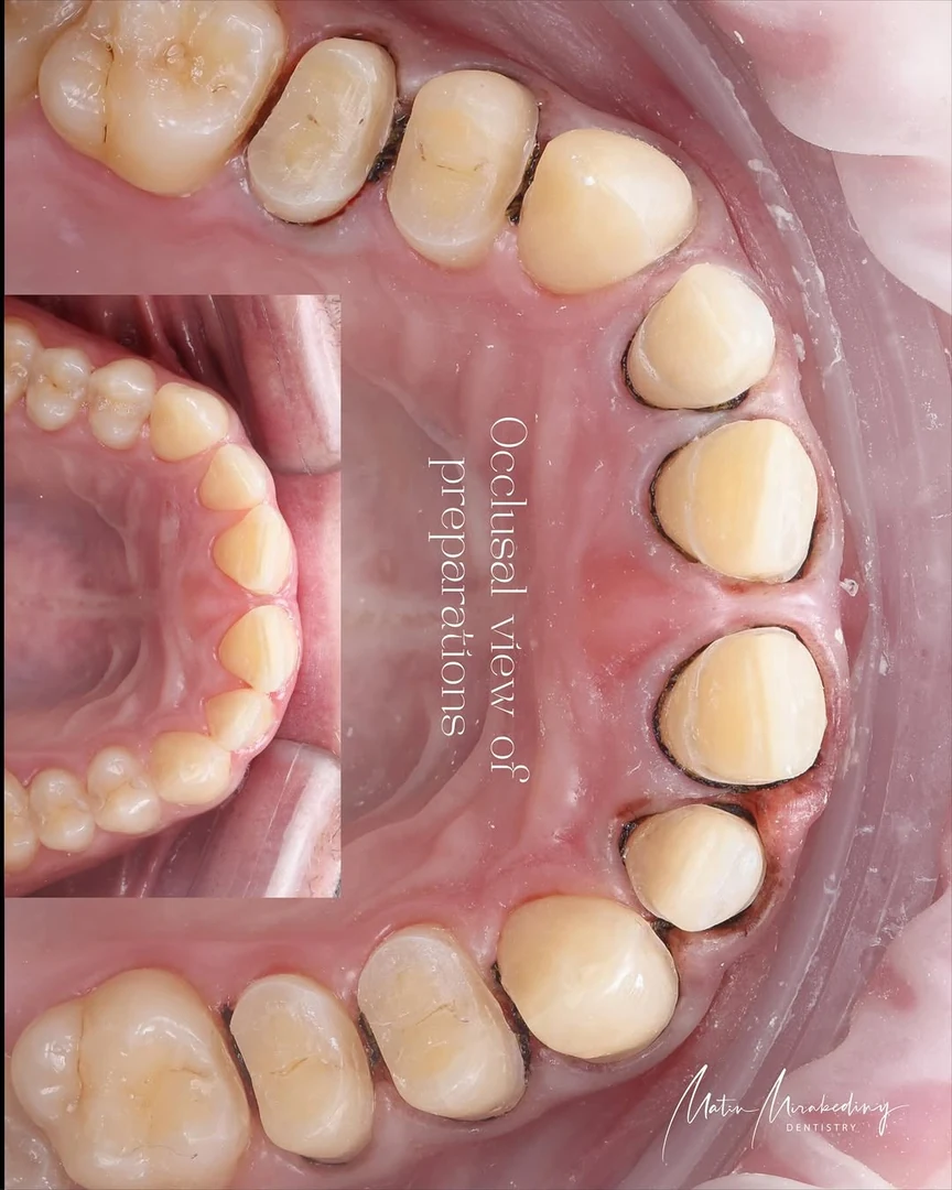 Restoration — stage seven