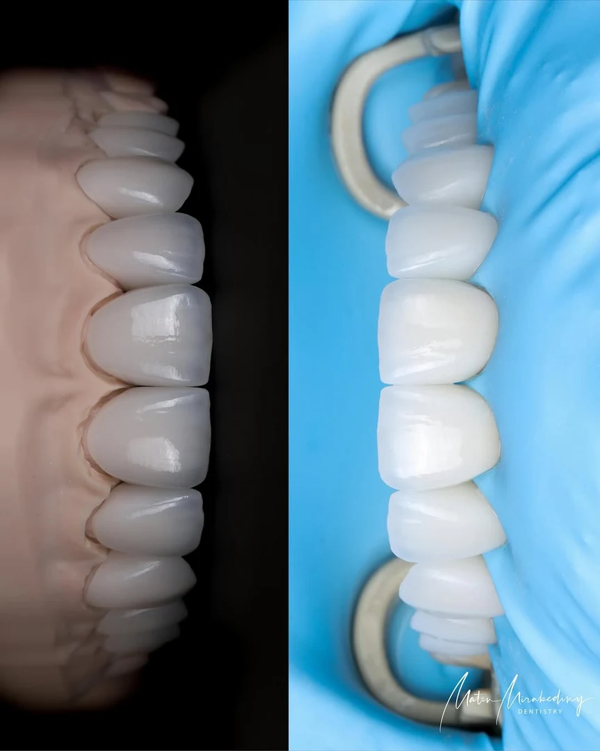 Restoration — final detail